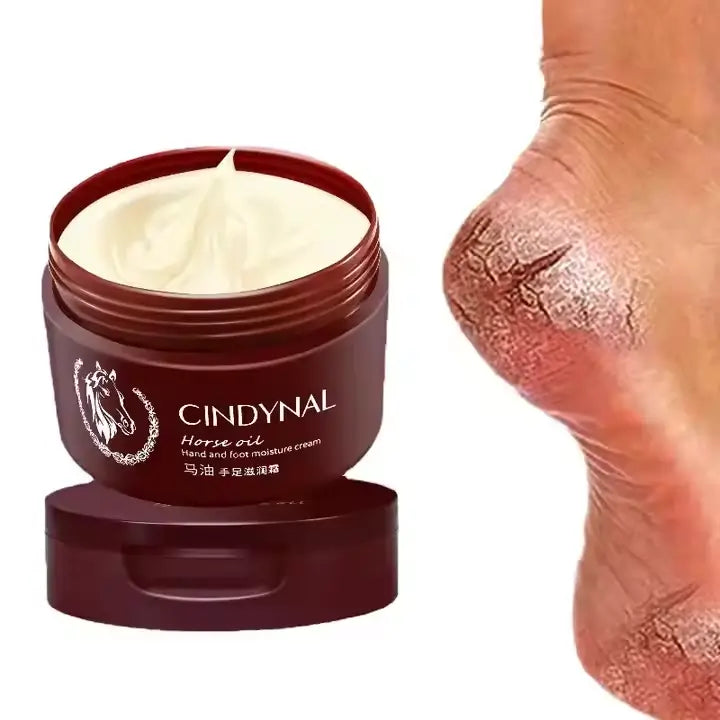 Crème Miracle CINDYNAL – Pieds Doux en 3 Jours