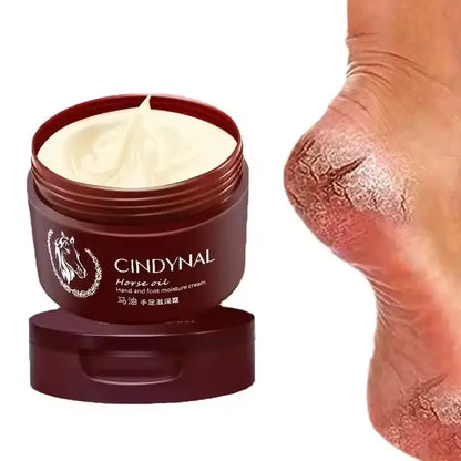 Crème Miracle CINDYNAL – Pieds Doux en 3 Jours